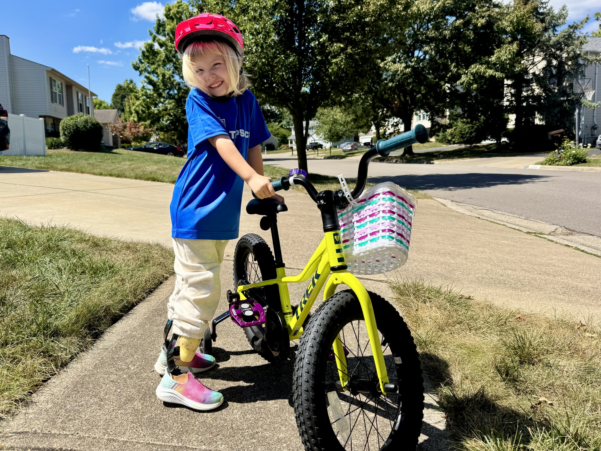 Gwen smiling next to her bright yellow Trek bike. She is wearing her prosthetic legs and pink shoes. The bike has pink magnetic pedals installed.
