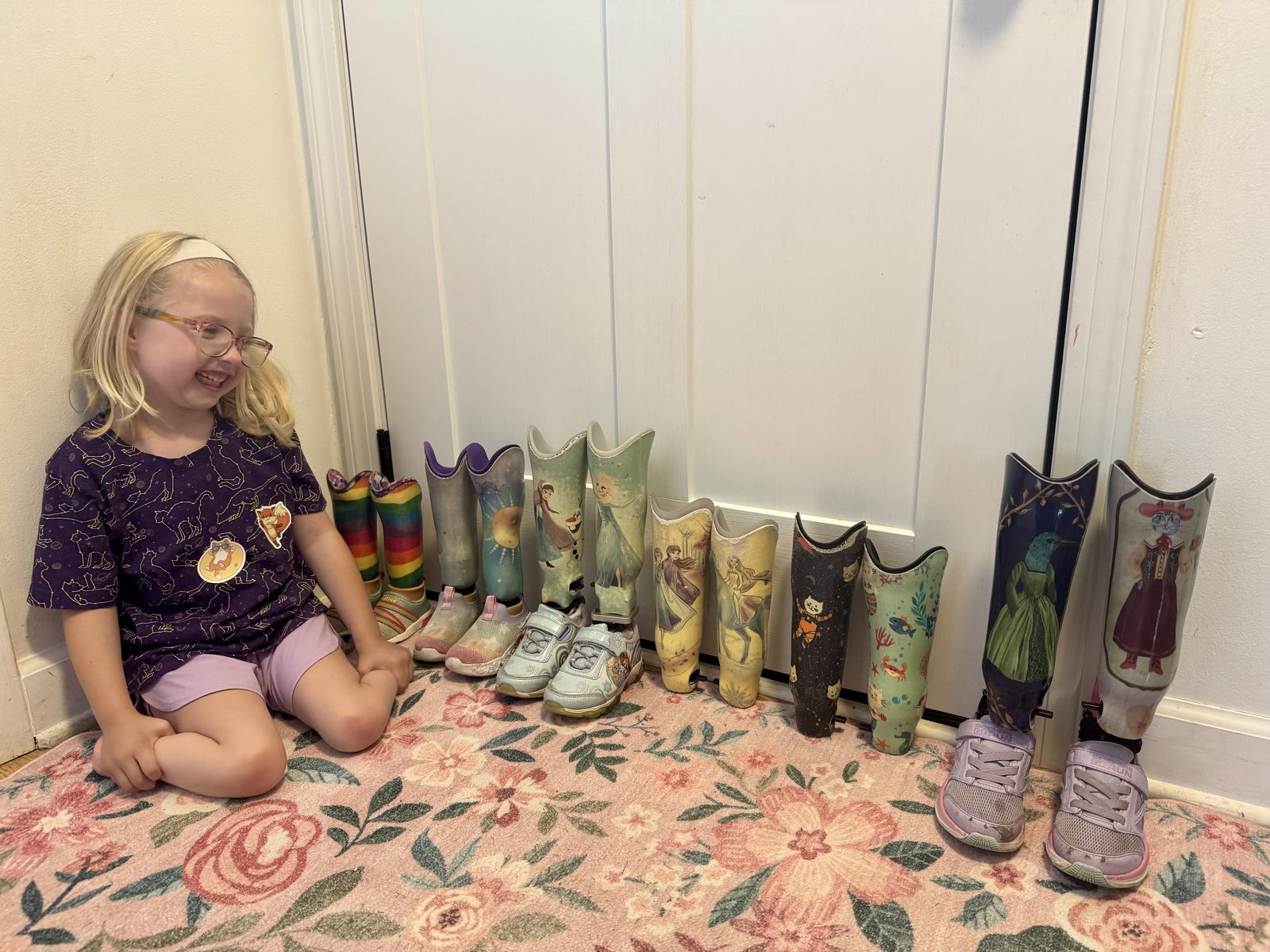 Gwen sitting beside her collection of prosthetics from early childhood through Set 6