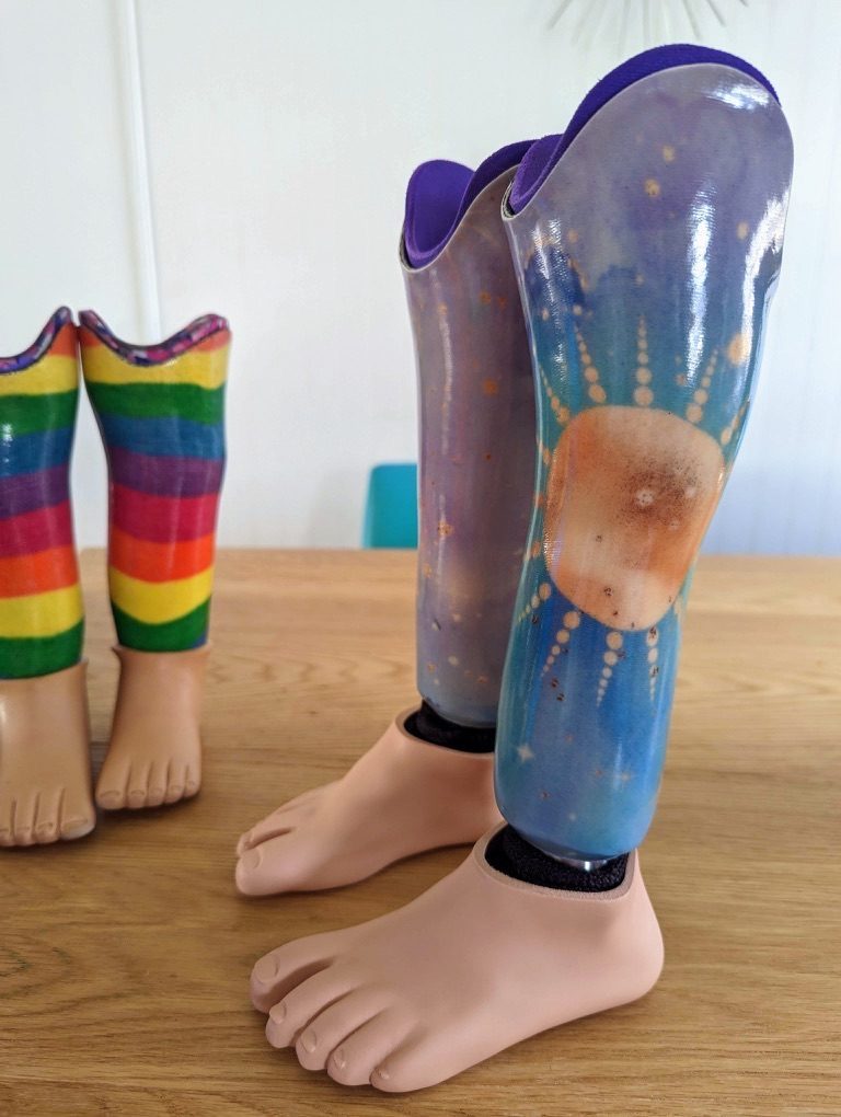 Front view of Gwen’s second set of prosthetics with a blue space and sun socket design, with her smaller rainbow first set behind them