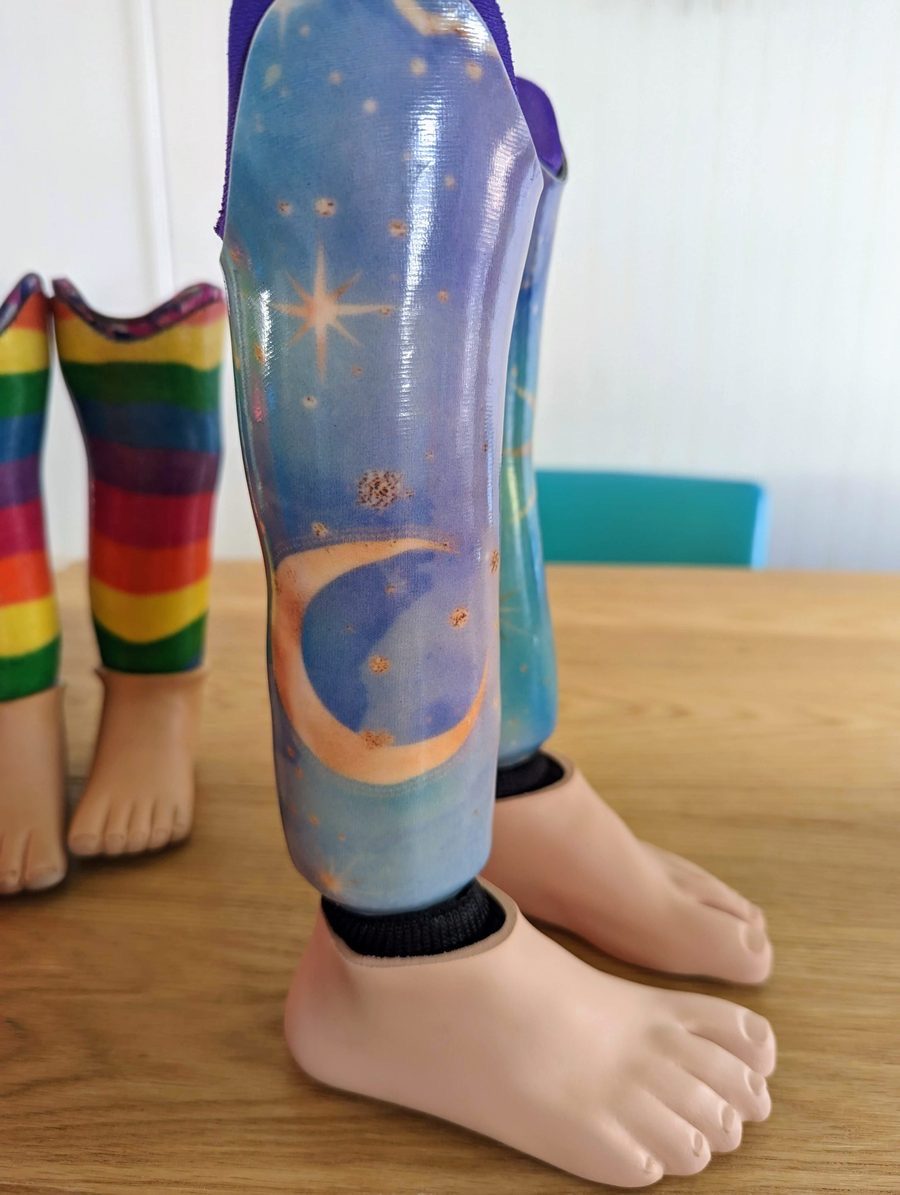Side view of Gwen’s second set of prosthetics with a blue night sky, moon, and stars design, with her rainbow first set beside them