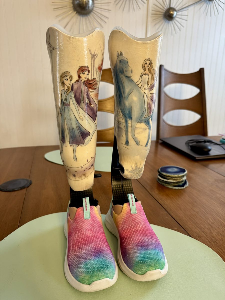 Front view of Gwen’s fourth set of prosthetics with Frozen designs, Formula feet, and rainbow sneakers