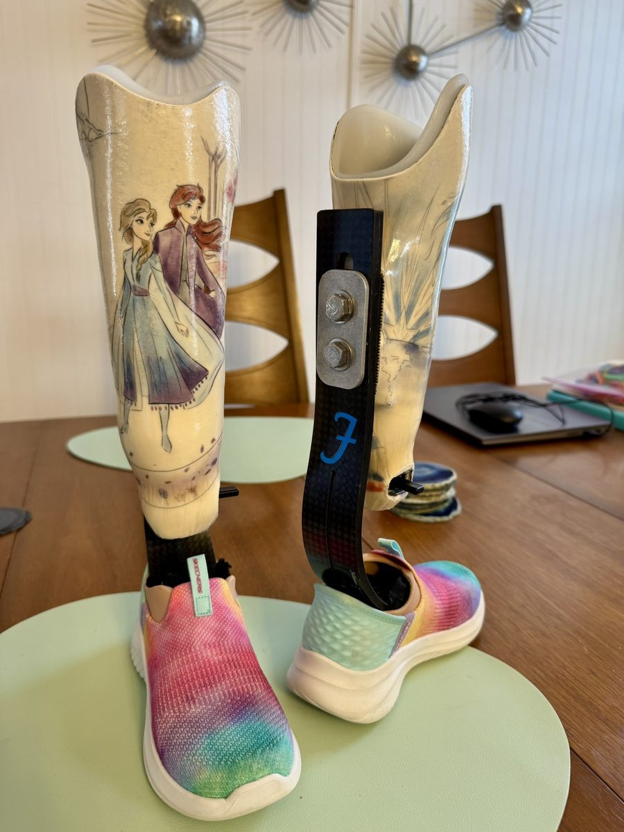 Side view of Gwen’s fourth set of prosthetics showing the Formula foot carbon fiber strut