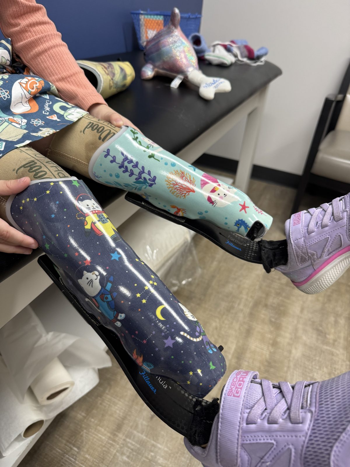 Gwen wearing her fifth set of prosthetics with space cat and mermaid cat socket designs