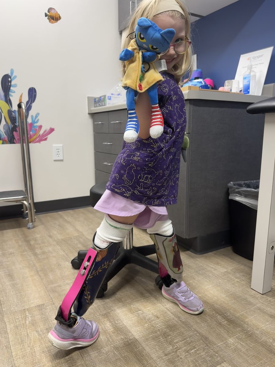 Gwen wearing her sixth set of prosthetics at her fitting appointment