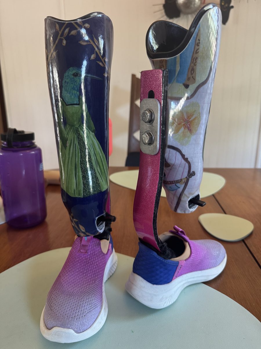 Side view showing the sparkly pink vinyl wrapped Formula feet on Gwen’s sixth set of prosthetics