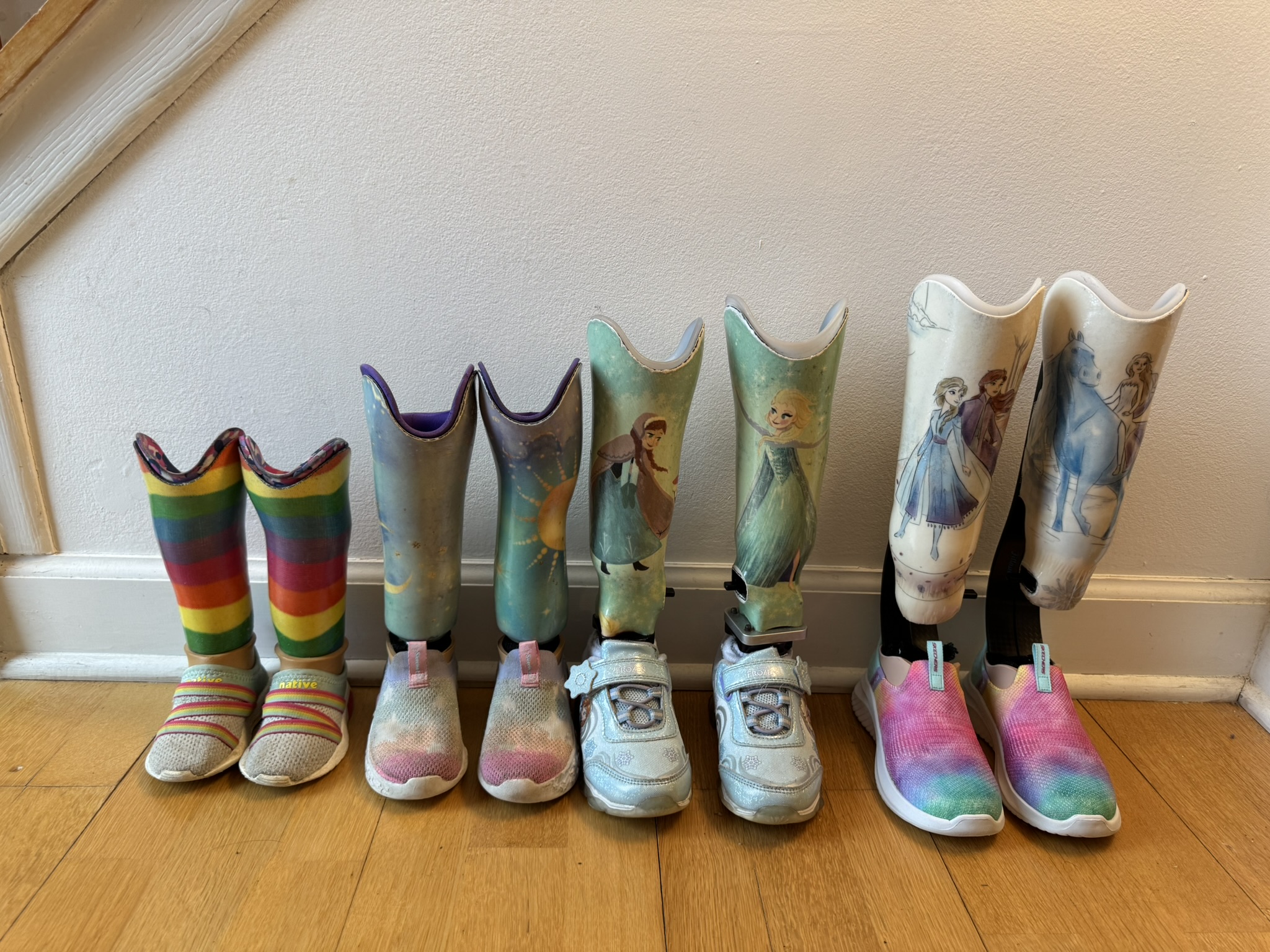 Gwen’s custom pediatric prosthetics with gel liners and pin lock system
